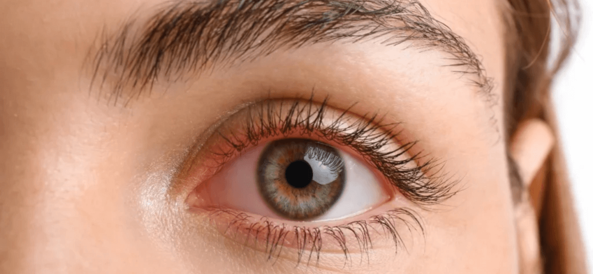 Irritação dos olhos – algumas possíveis causas e cuidados!