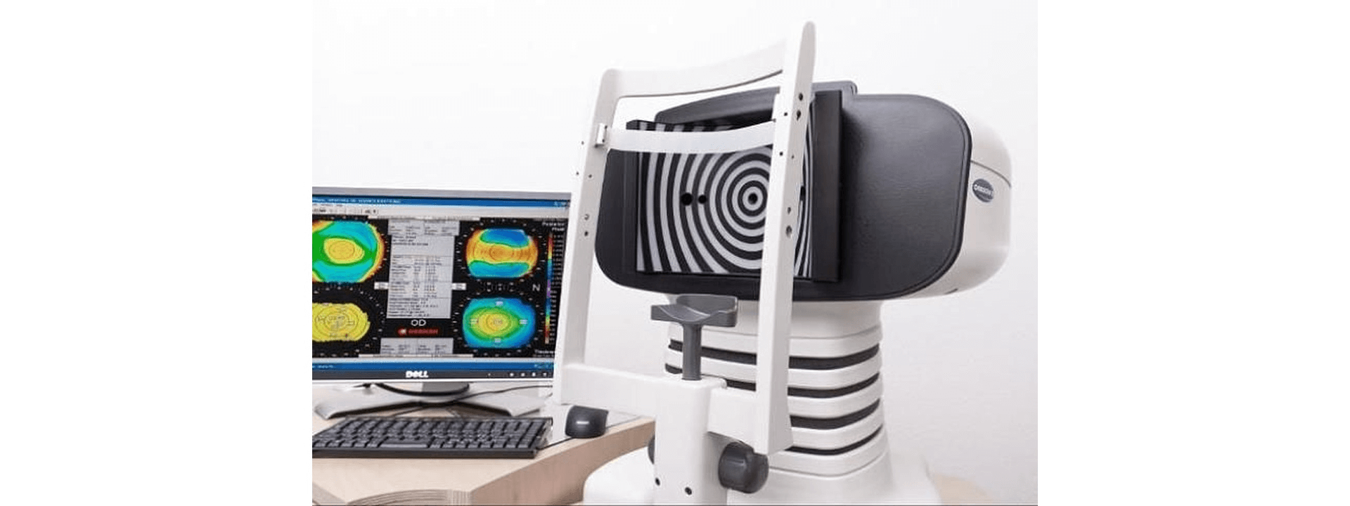 Topografia Corneal