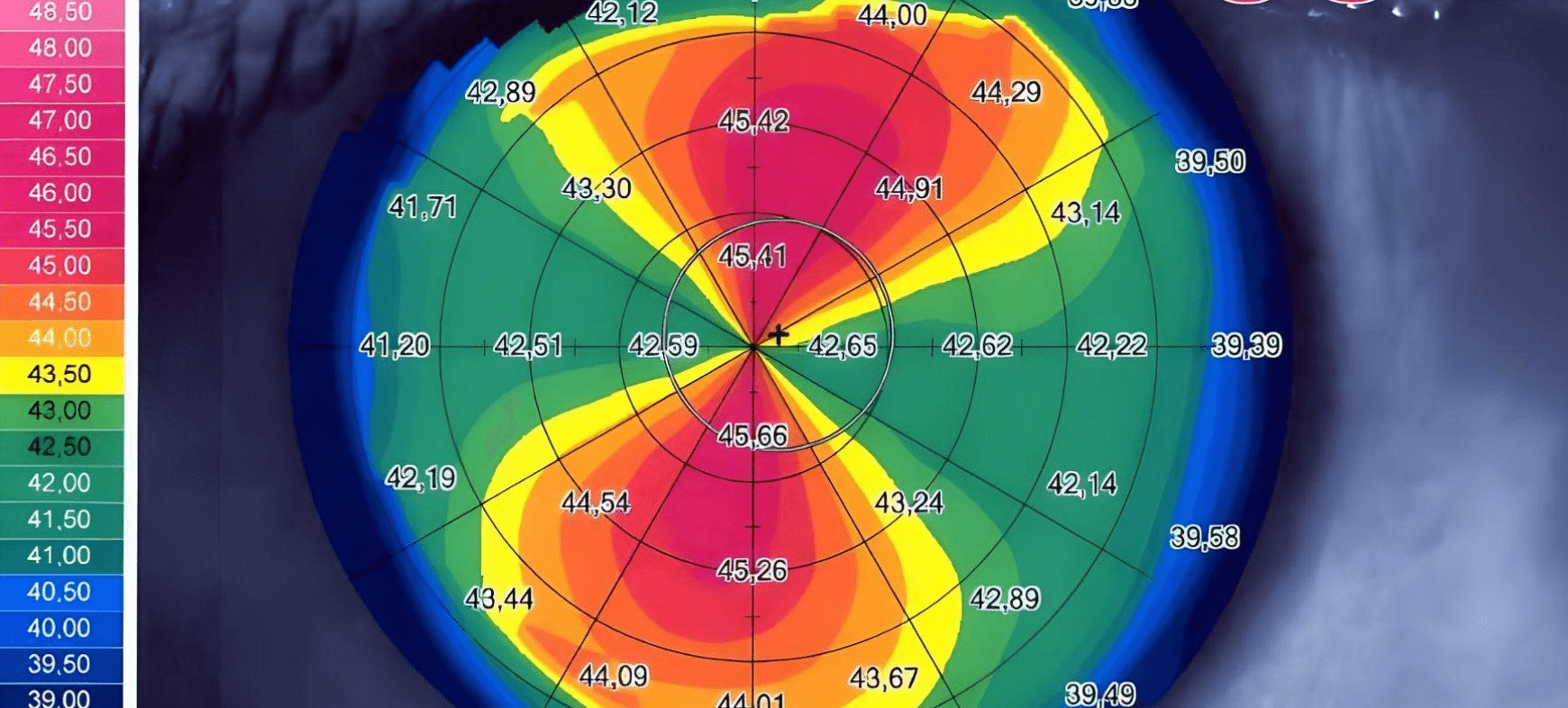 Topografía